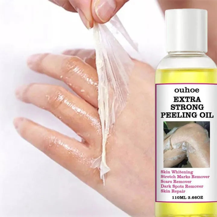 Yellow Peeling Oil 110ml Super Strength Dead Skin Remover