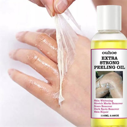 Yellow Peeling Oil 110ml Super Strength Dead Skin Remover