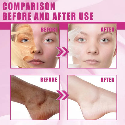 Yellow Peeling Oil 110ml Super Strength Dead Skin Remover